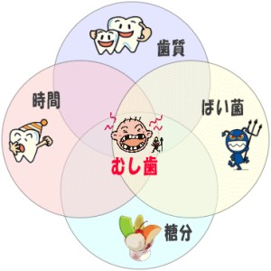 虫歯ができる原因